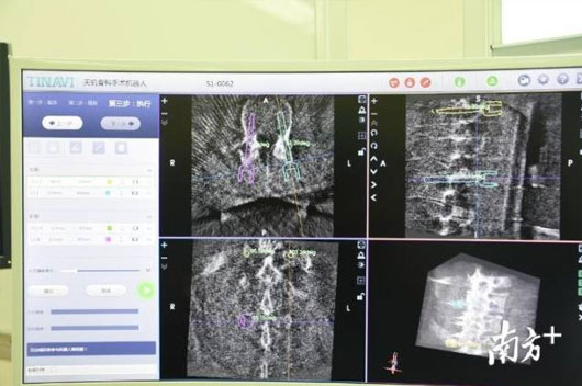 1589437941918033.jpg 2.jpg