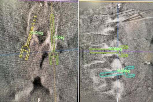 1589440897429714.jpg 4.jpg