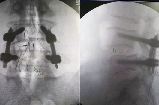 1589440937133826.jpg 6.jpg