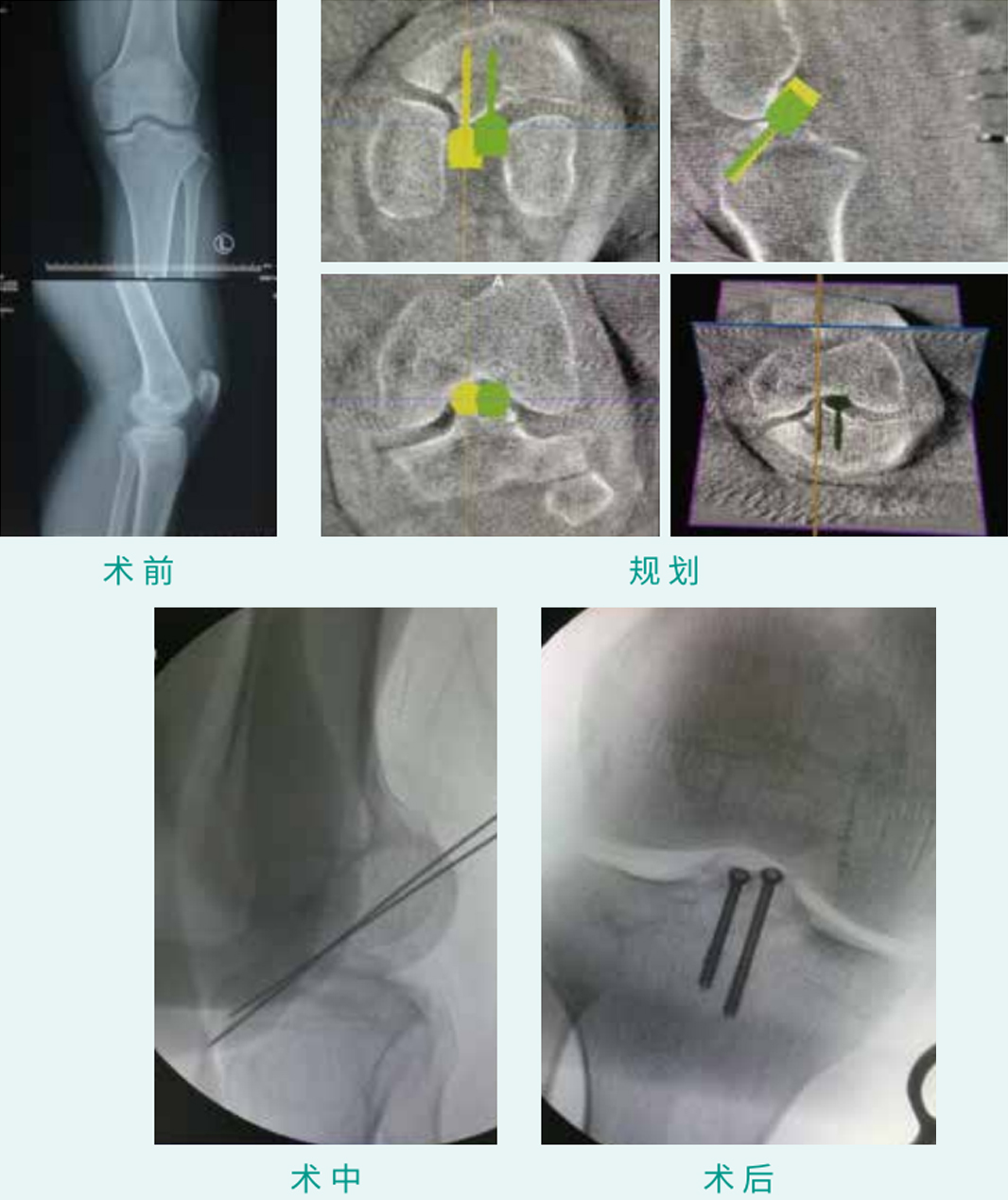 1590376855977055.jpg 05-1.jpg