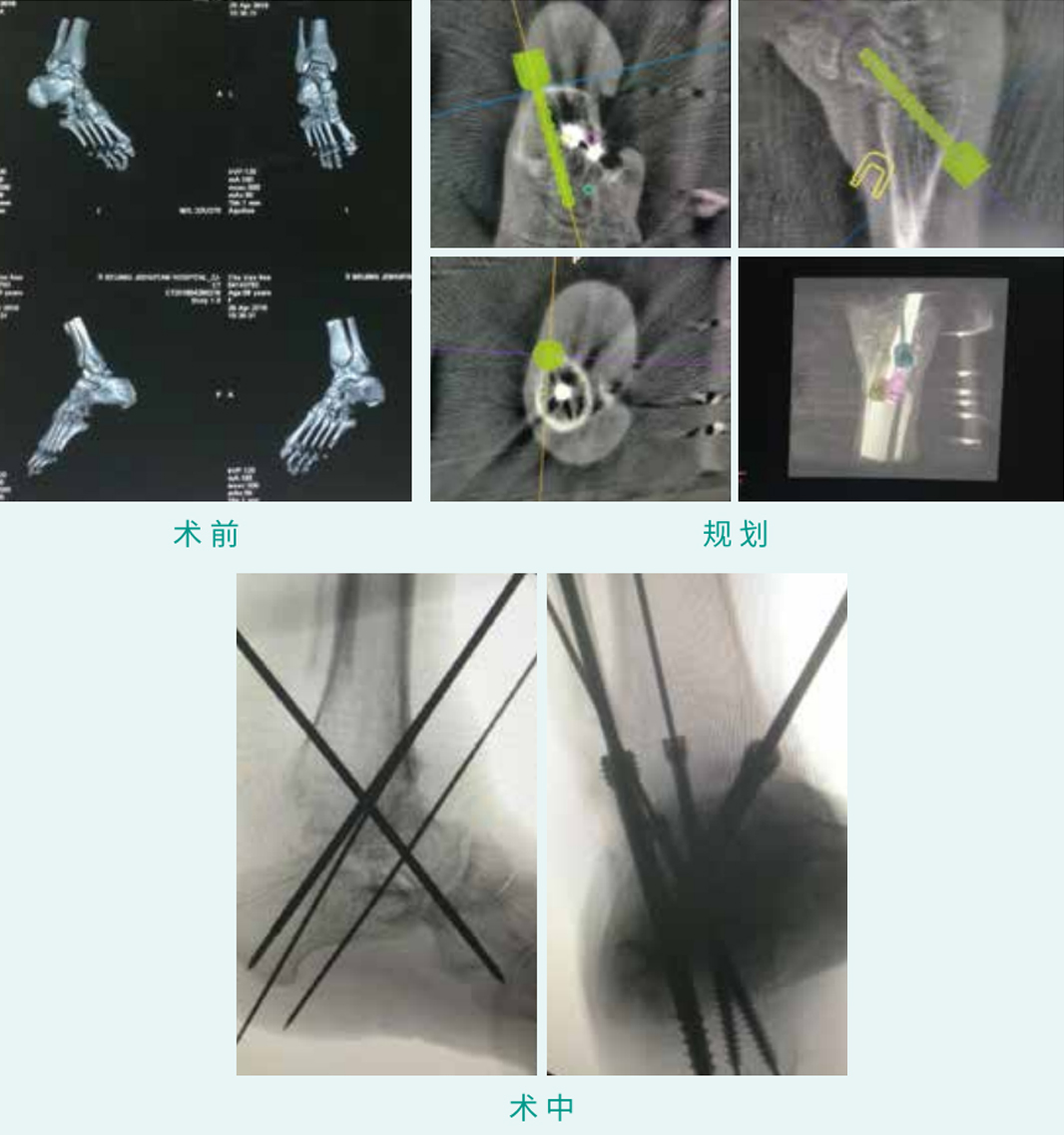 1590377306128820.jpg 06-01.jpg