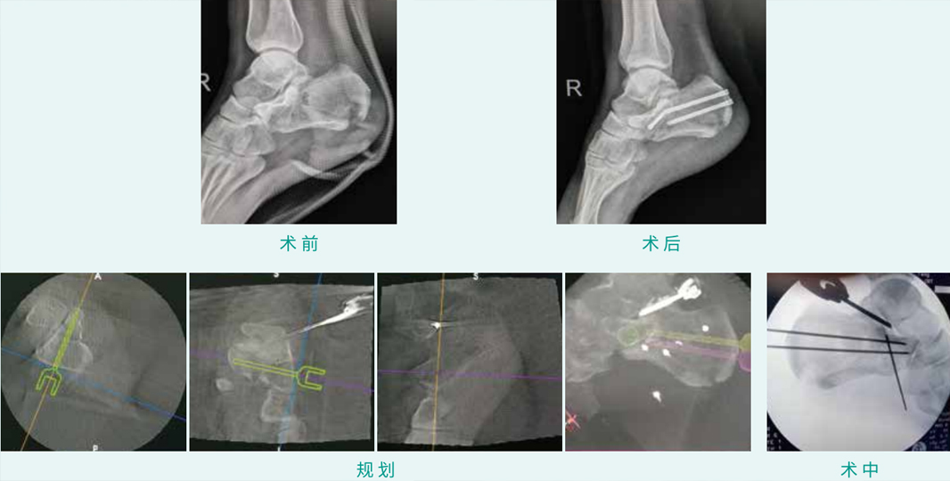 1590378448251270.jpg 08-1.jpg