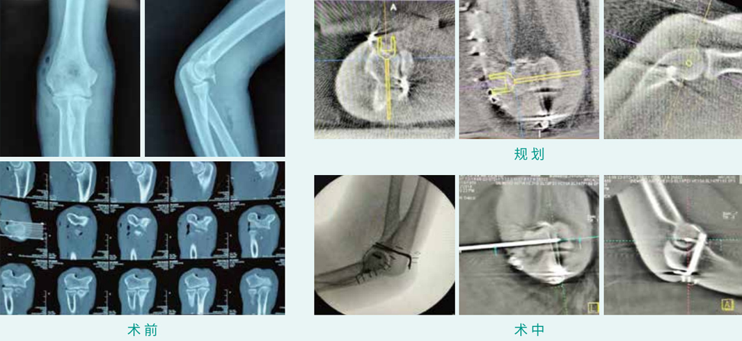 1590378749166242.jpg 09-1.jpg