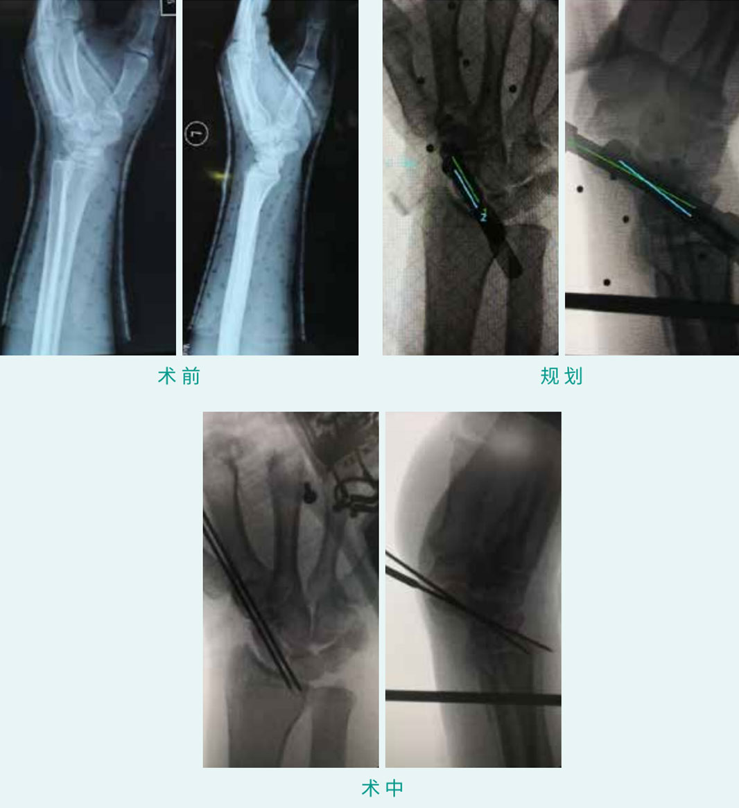 1590378962735688.jpg 10-1.jpg