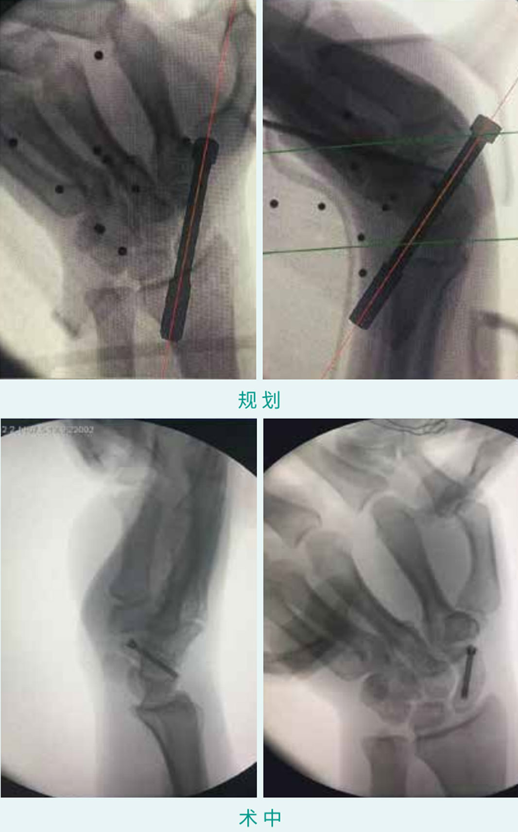 1590379131905262.jpg 11-1.jpg