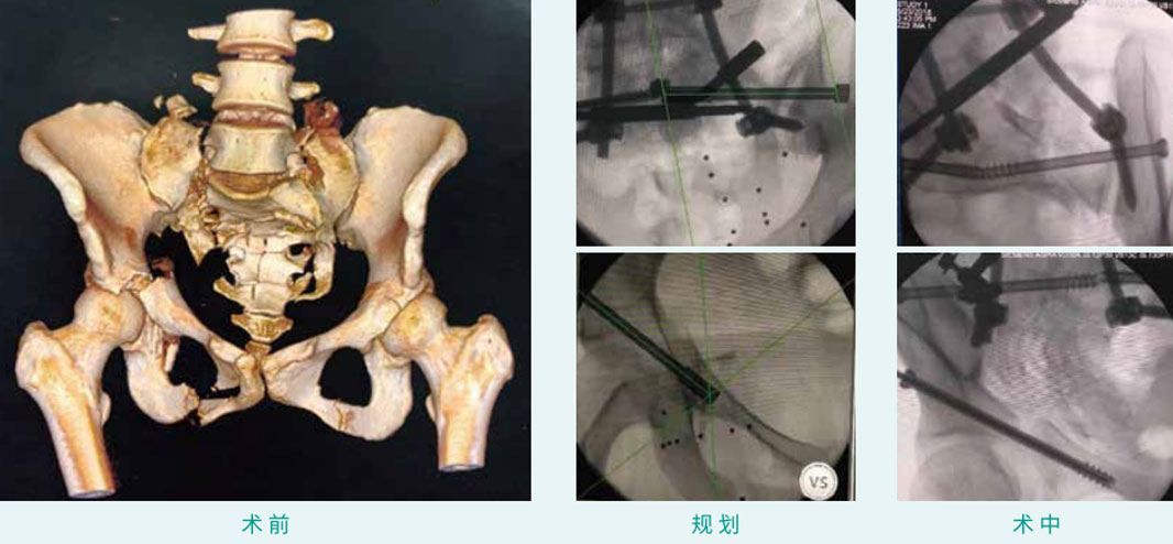 1590383149191963.jpg 13-1.jpg