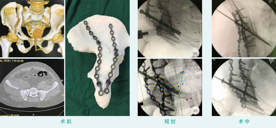 1590383356265030.jpg 14-1.jpg