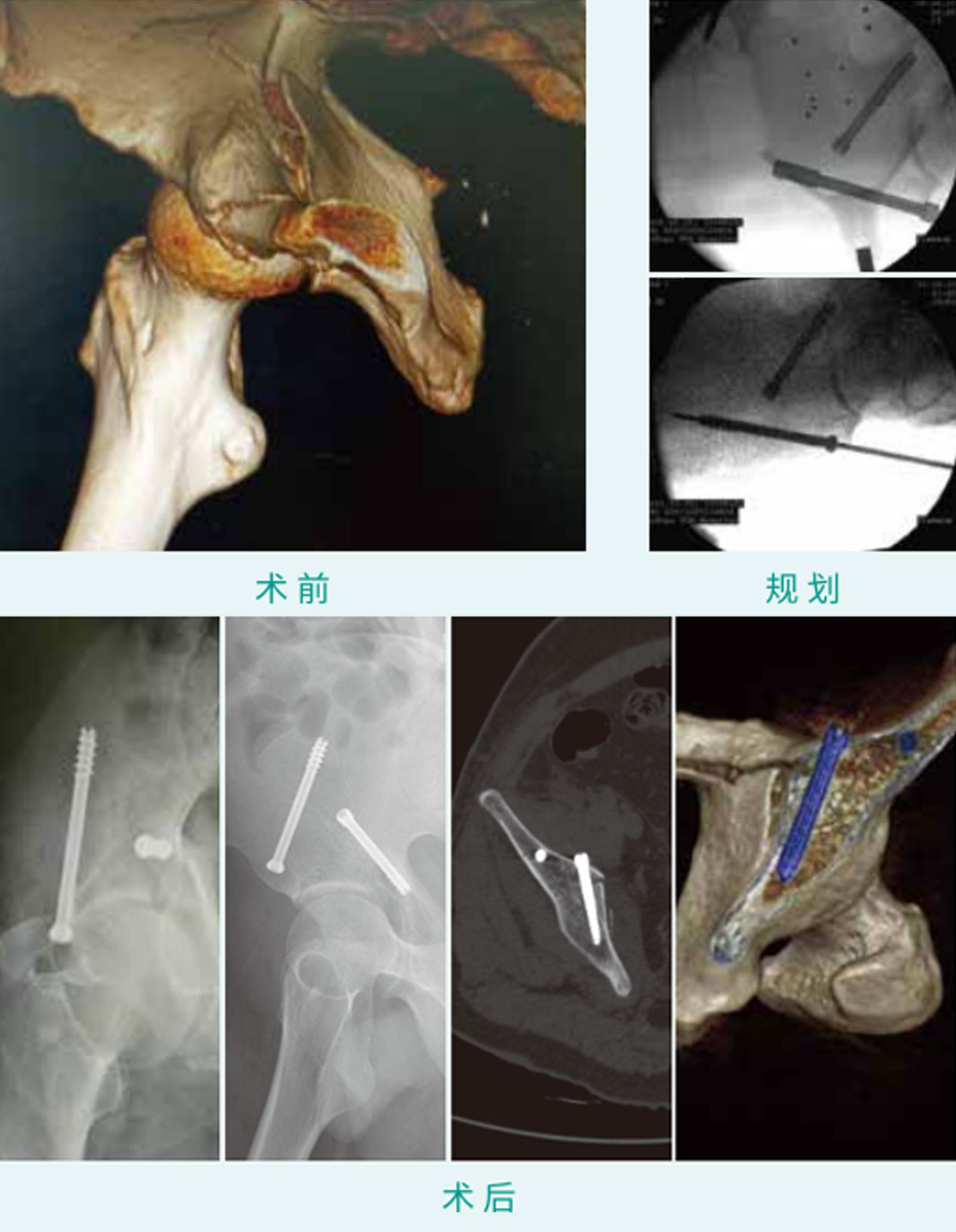 1590383559493984.jpg 15-1.jpg