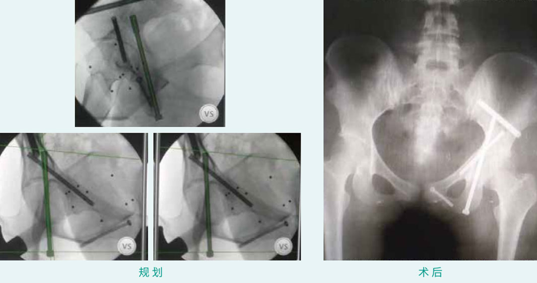 1590383720563664.jpg 16-1.jpg