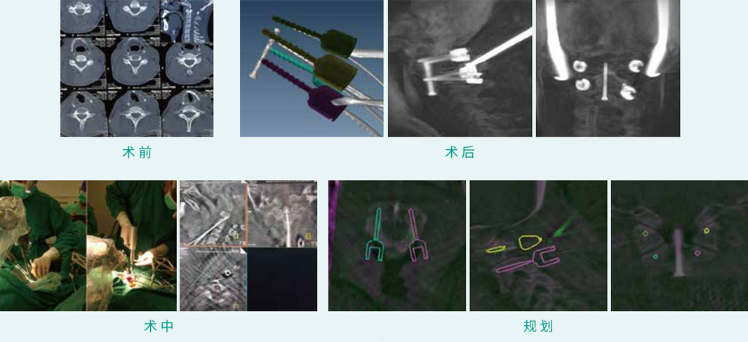 1590384879894493.jpg 22-1.jpg