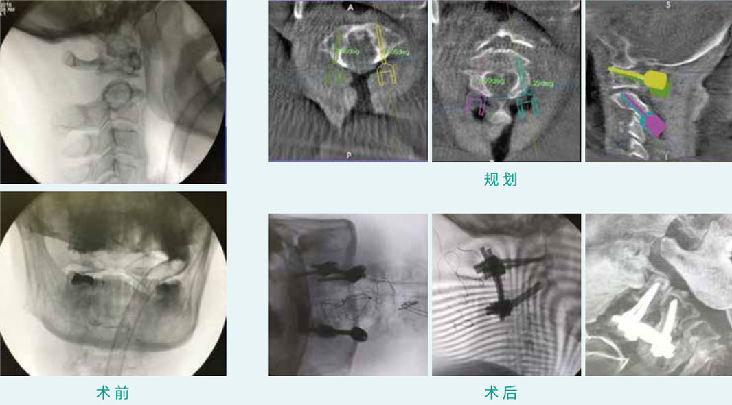 1590385153854073.jpg 25-1.jpg