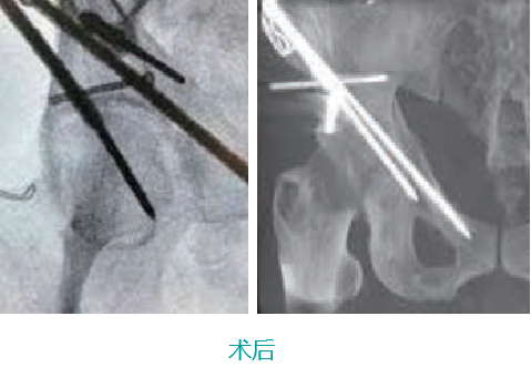 1642581347753696.png image.png